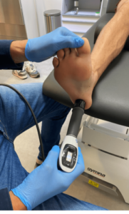 Shockwave als onderdeel therapie bij Sengers podotherapie Wijchen