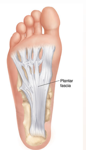 Hielpijn en fasciitis plantaris – wat is het en wat kunt u doen?