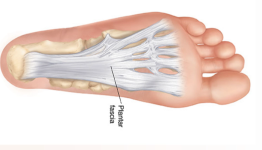 Hielpijn en fasciitis plantaris – wat is het en wat kunt u doen?