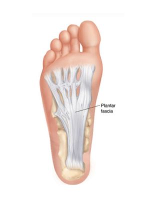 Hielpijn en fasciitis plantaris – wat is het en wat kunt u doen?